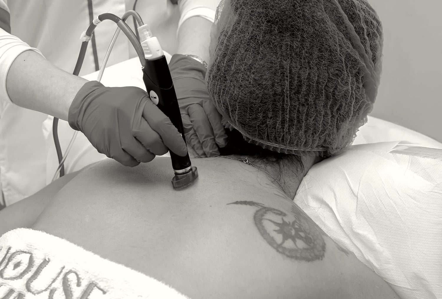 Laser Hair Removal at RVRS MED
